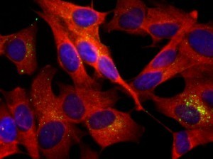 SH-SY5Y-APP cells treated with chloroquine show a redistribution of the autophagosome marker LC3B (in red) from a cytosolic to a vesicular pattern, consistent with autophagic vesicle accumulation. 